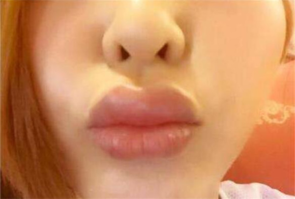 芒果和什么不能一起吃,芒果跟什么水果相克