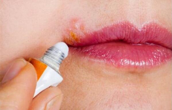 芒果过敏第几天最严重,芒果过敏几天能自愈呢