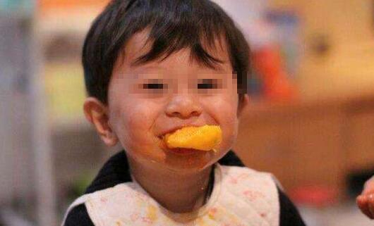 吃芒果过敏的症状图片,小孩芒果过敏症状图片,成年人芒果过敏图片